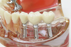 歯科技工士が常駐
