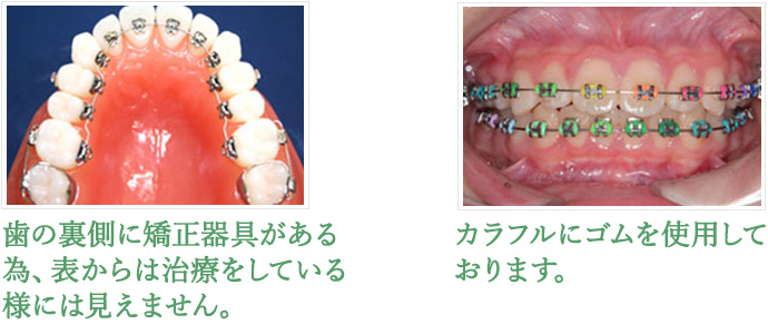 矯正歯科について